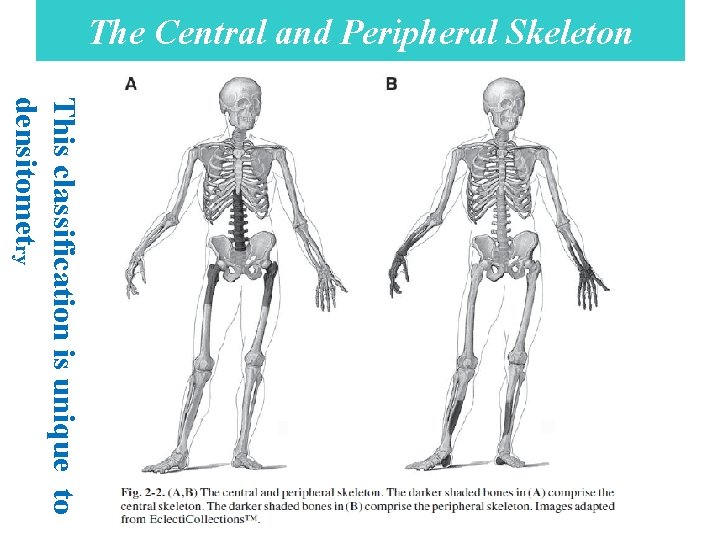 The Central and Peripheral Skeleton This classification is unique to densitometry 