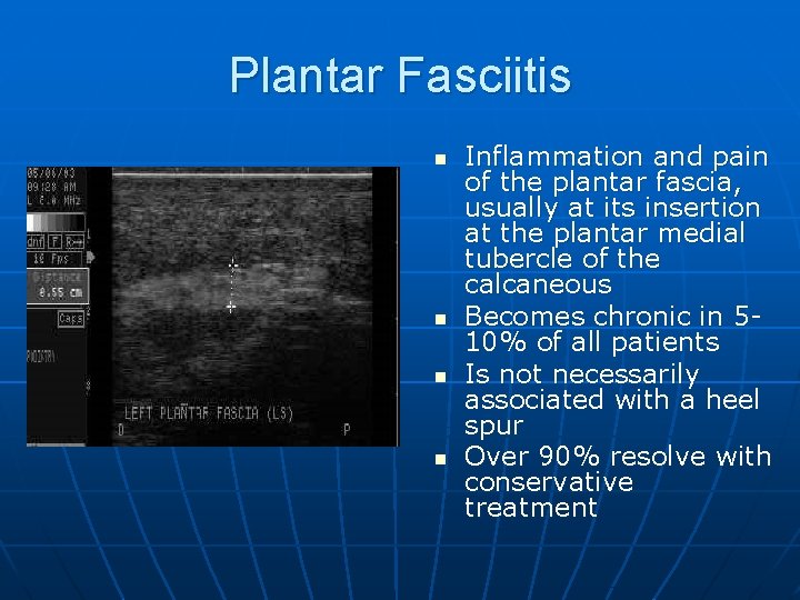 Plantar Fasciitis n n Inflammation and pain of the plantar fascia, usually at its