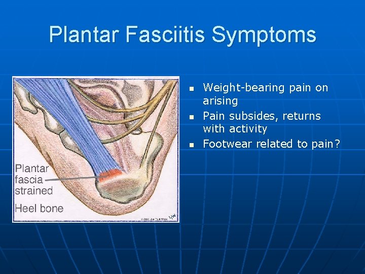Plantar Fasciitis Symptoms n n n Weight-bearing pain on arising Pain subsides, returns with