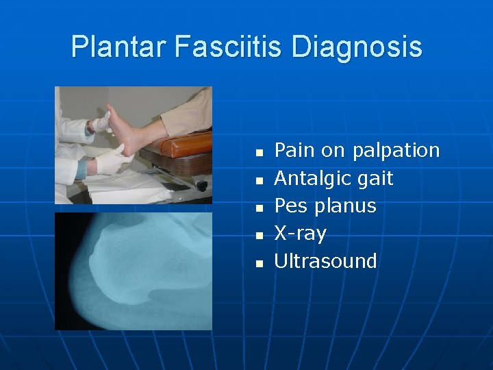 Plantar Fasciitis Diagnosis n n n Pain on palpation Antalgic gait Pes planus X-ray