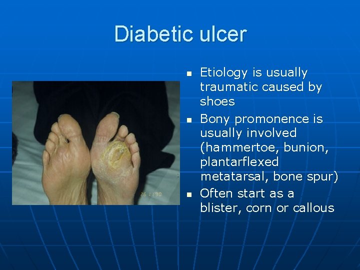 Diabetic ulcer n n n Etiology is usually traumatic caused by shoes Bony promonence