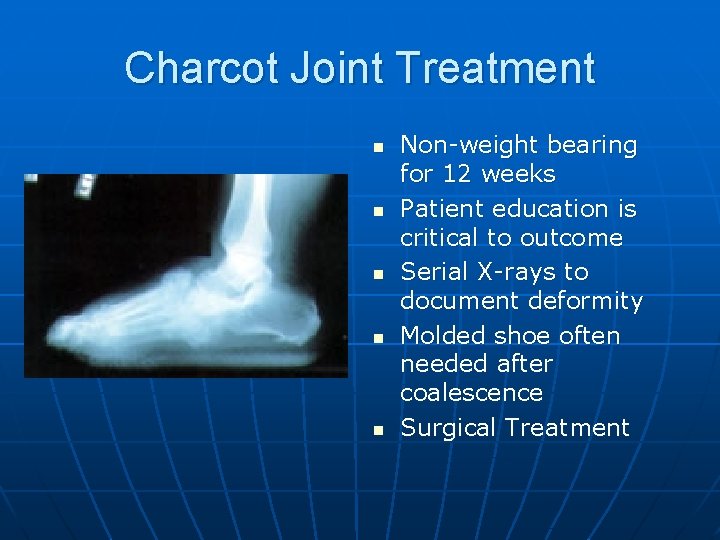 Charcot Joint Treatment n n n Non-weight bearing for 12 weeks Patient education is