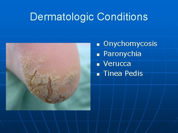 Dermatologic Conditions n n Onychomycosis Paronychia Verucca Tinea Pedis 