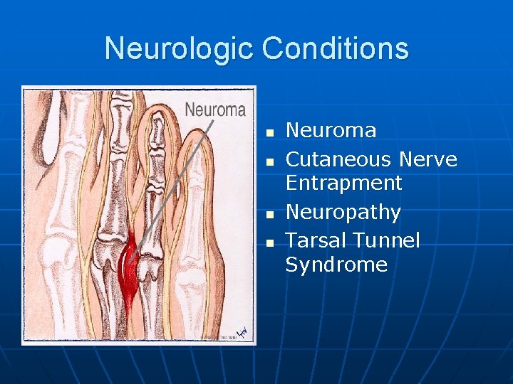 Neurologic Conditions n n Neuroma Cutaneous Nerve Entrapment Neuropathy Tarsal Tunnel Syndrome 