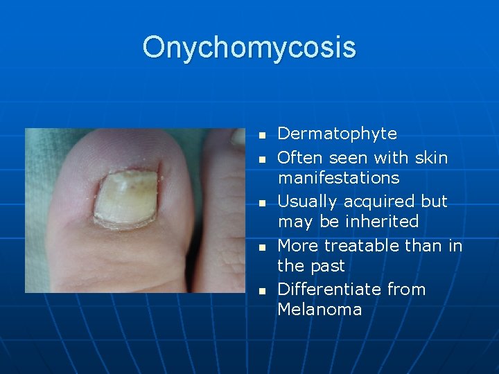 Onychomycosis n n n Dermatophyte Often seen with skin manifestations Usually acquired but may