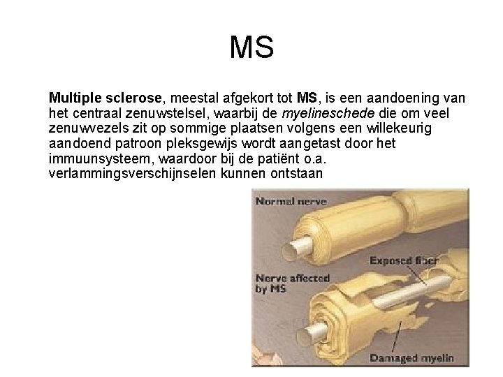 MS Multiple sclerose, meestal afgekort tot MS, is een aandoening van het centraal zenuwstelsel,