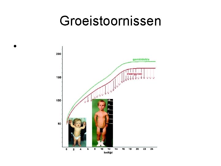 Groeistoornissen • 