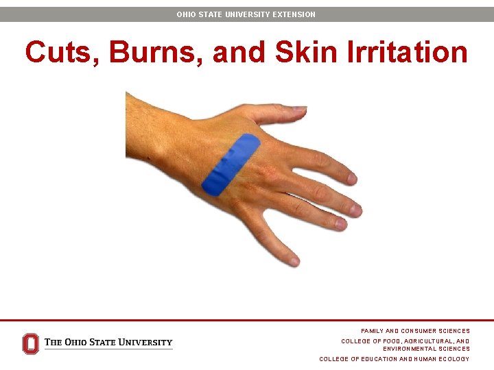 OHIO STATE UNIVERSITY EXTENSION Cuts, Burns, and Skin Irritation FAMILY AND CONSUMER SCIENCES COLLEGE