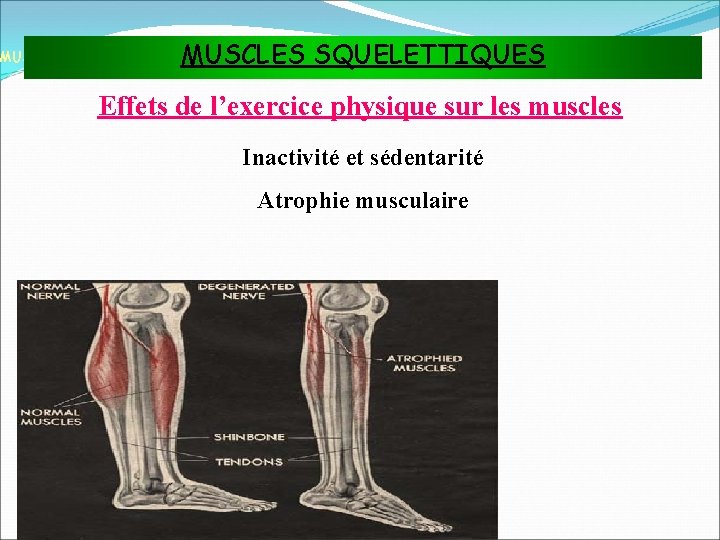 MUSCLES SQUELETTIQUES MUSCLES ET TISSU MUSCULAIRE Effets de l’exercice physique sur les muscles Inactivité