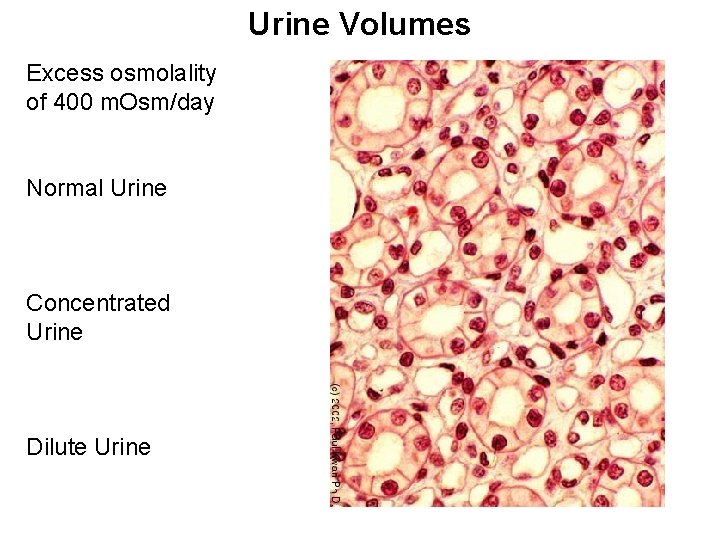 Urine Volumes Excess osmolality of 400 m. Osm/day Normal Urine Concentrated Urine Dilute Urine
