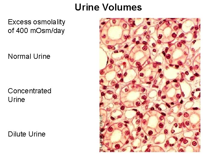 Urine Volumes Excess osmolality of 400 m. Osm/day Normal Urine Concentrated Urine Dilute Urine