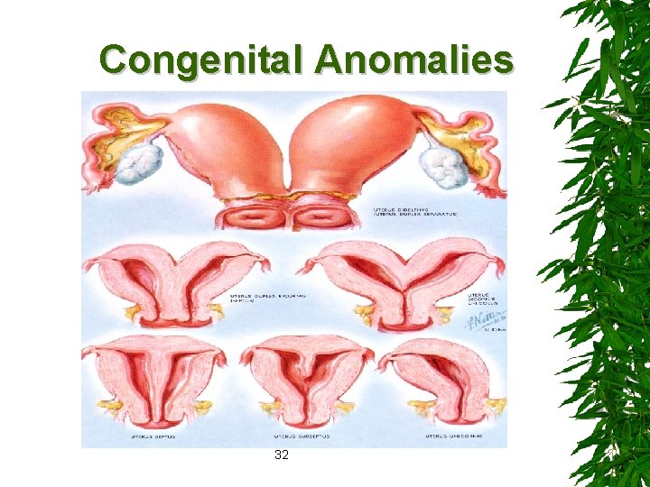 Congenital Anomalies 32 