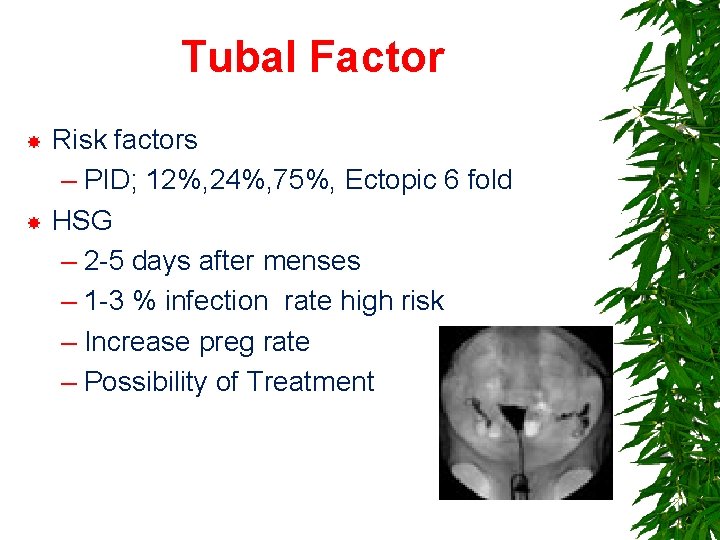 Tubal Factor Risk factors – PID; 12%, 24%, 75%, Ectopic 6 fold HSG –