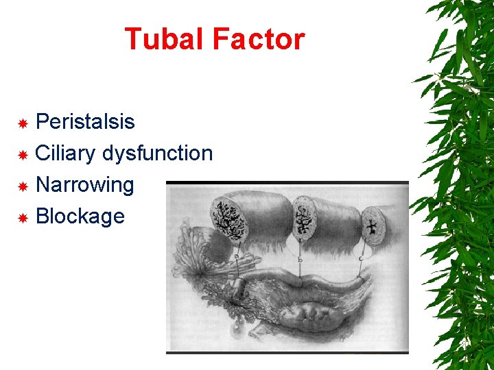 Tubal Factor Peristalsis Ciliary dysfunction Narrowing Blockage 39 