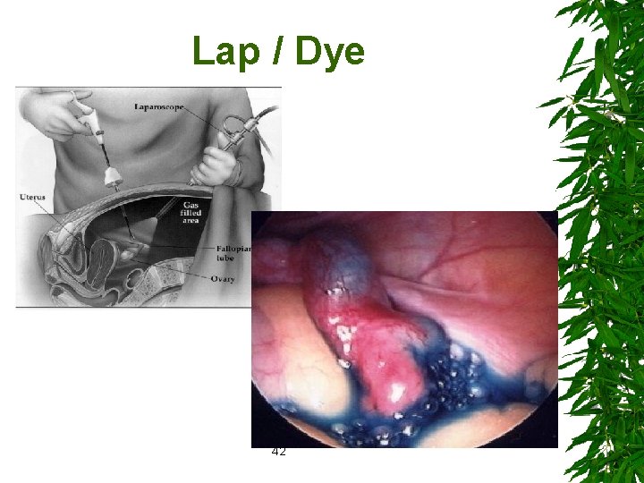 Lap / Dye 42 