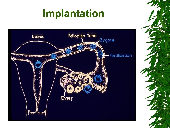 Implantation 