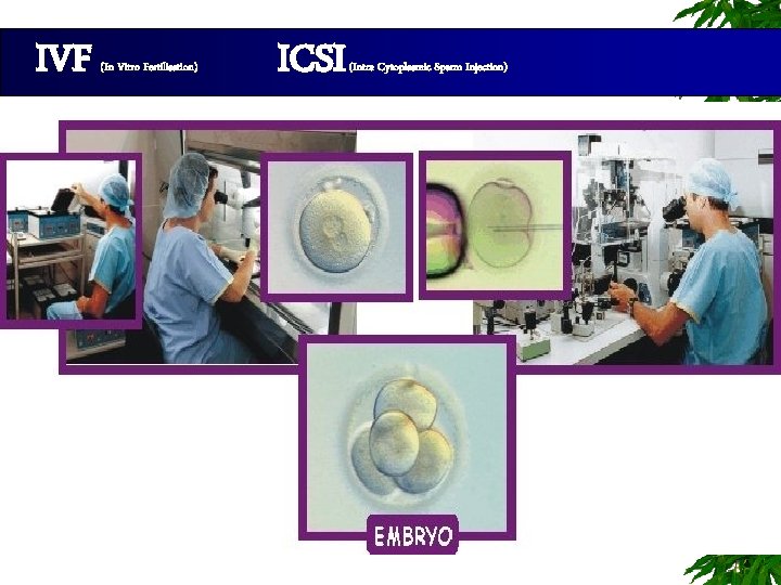 IVF (In Vitro Fertilisation) ICSI 63 (Intra Cytoplasmic Sperm Injection) 