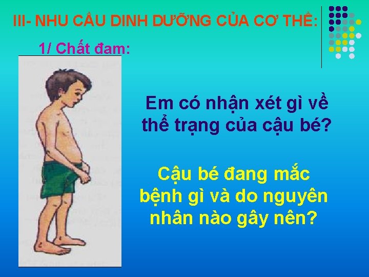 III- NHU CẦU DINH DƯỠNG CỦA CƠ THỂ: 1/ Chất đạm: Em có nhận