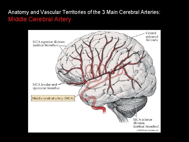 Anatomy and Vascular Territories of the 3 Main Cerebral Arteries: Middle Cerebral Artery 