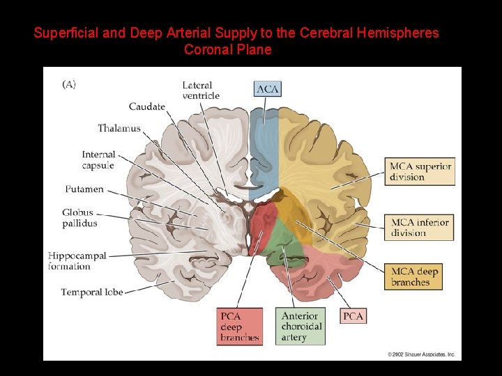 Superficial and Deep Arterial Supply to the Cerebral Hemispheres Coronal Plane 