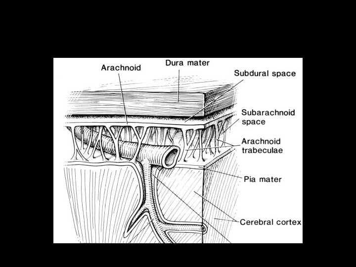 Intracranial Hemorrhage 