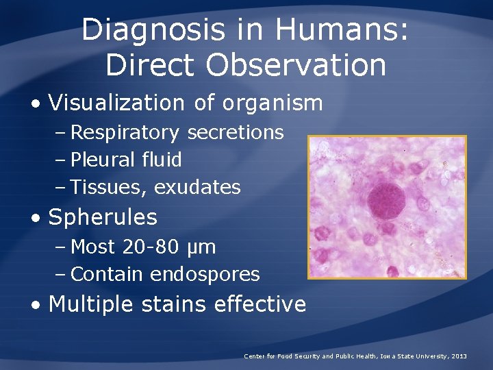 Diagnosis in Humans: Direct Observation • Visualization of organism – Respiratory secretions – Pleural