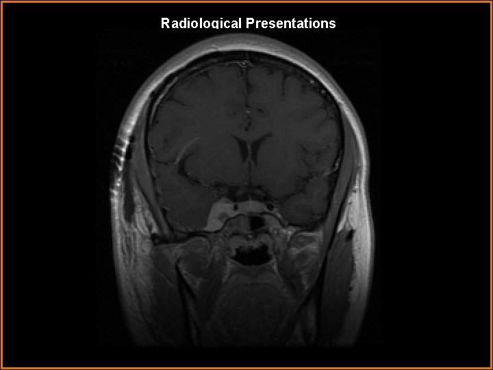 Radiological Presentations 