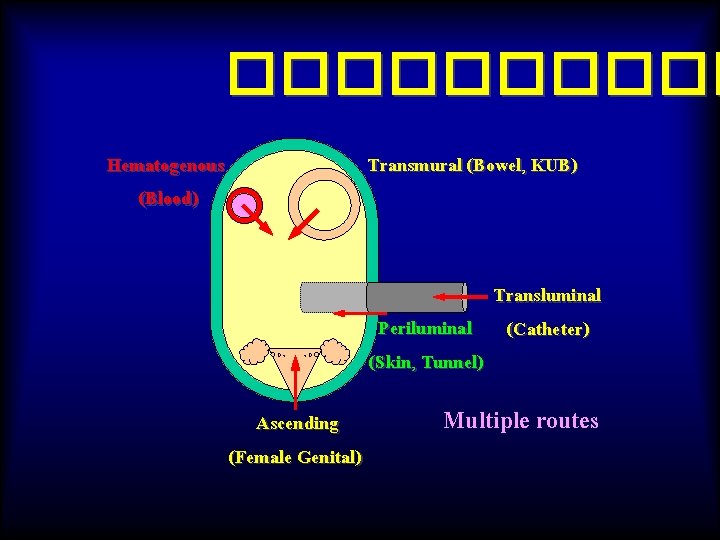 ����� Hematogenous (Blood) Transmural (Bowel, KUB) Transluminal Periluminal (Catheter) (Skin, Tunnel) Ascending (Female Genital)