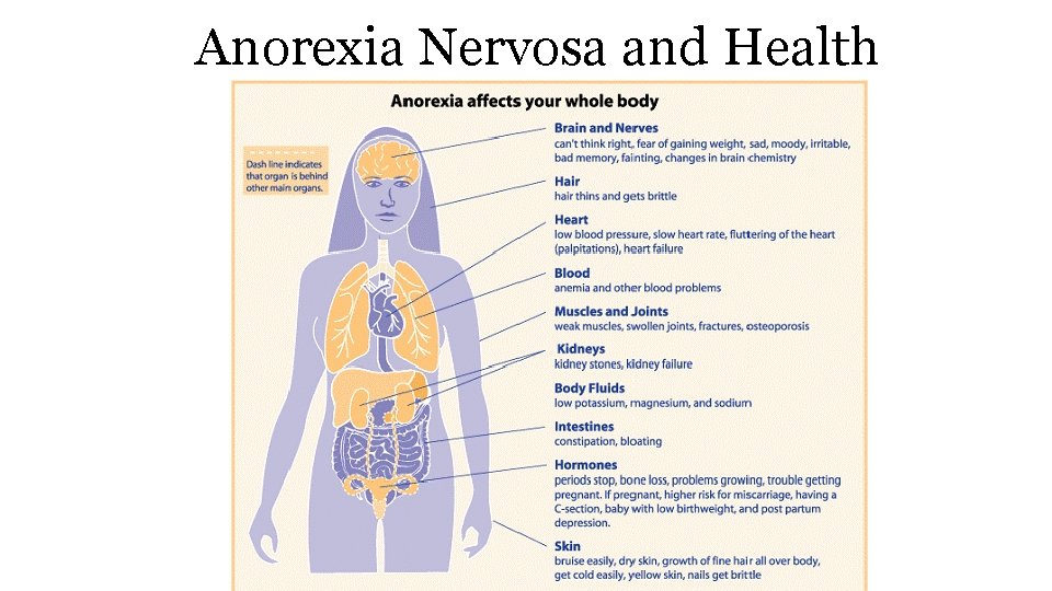 Anorexia Nervosa and Health 