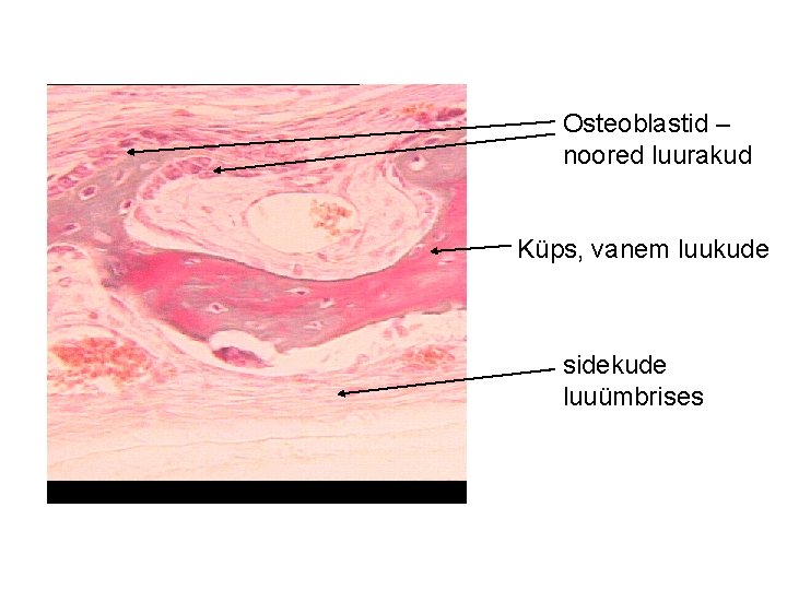 Osteoblastid – noored luurakud Küps, vanem luukude sidekude luuümbrises 