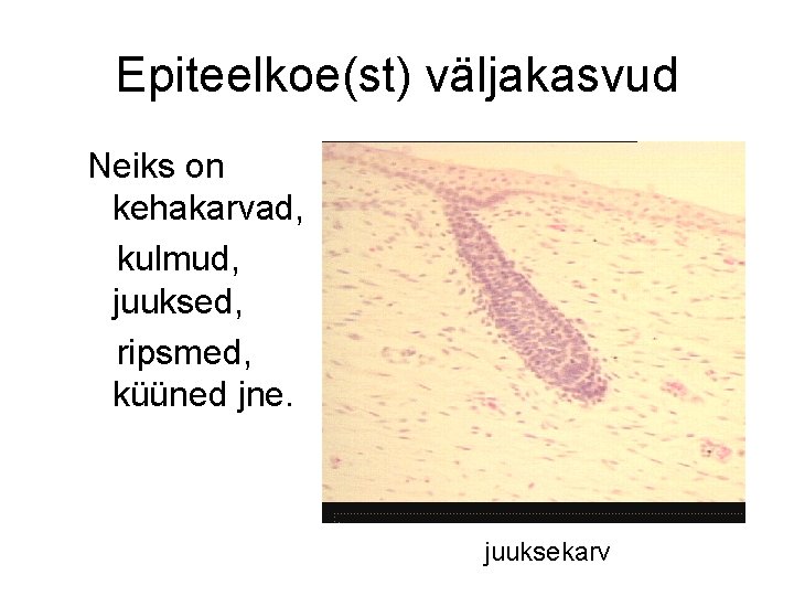 Epiteelkoe(st) väljakasvud Neiks on kehakarvad, kulmud, juuksed, ripsmed, küüned jne. juuksekarv 