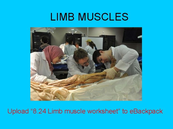 LIMB MUSCLES Upload “ 8. 24 Limb muscle worksheet” to e. Backpack 