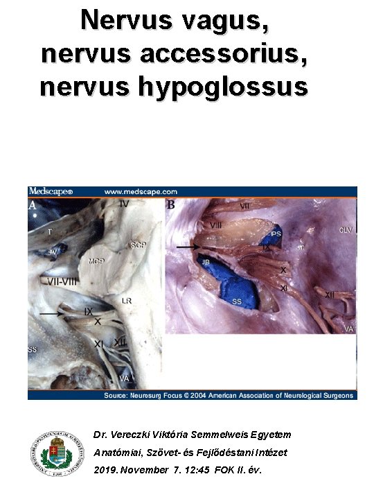 Nervus vagus, nervus accessorius, nervus hypoglossus Dr. Vereczki Viktória Semmelweis Egyetem Anatómiai, Szövet- és