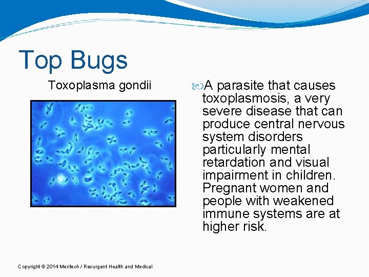 Top Bugs Toxoplasma gondii Copyright © 2014 Meritech / Resurgent Health and Medical A Top Bugs Toxoplasma gondii Copyright © 2014 Meritech / Resurgent Health and Medical A