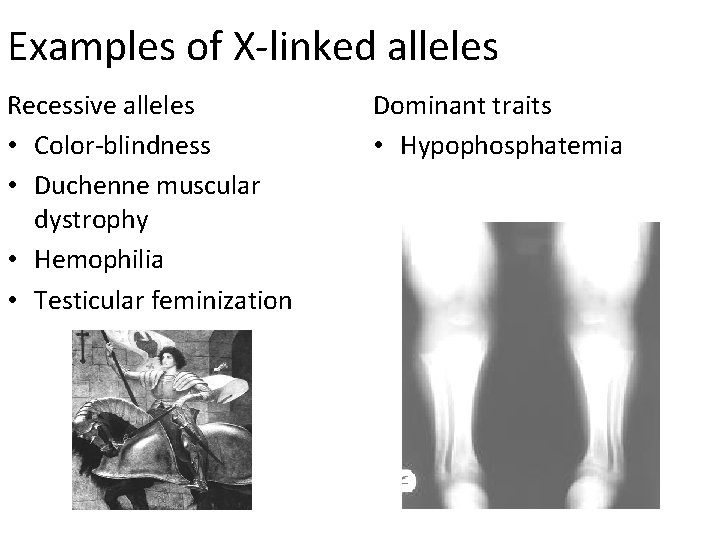 Examples of X-linked alleles Recessive alleles • Color-blindness • Duchenne muscular dystrophy • Hemophilia
