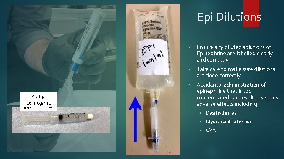Epi Dilutions PD Epi 10 mcg/m. L Date Time • Ensure any diluted solutions