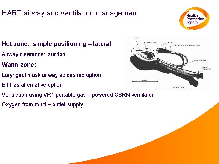 HART airway and ventilation management Hot zone: simple positioning – lateral Airway clearance: suction