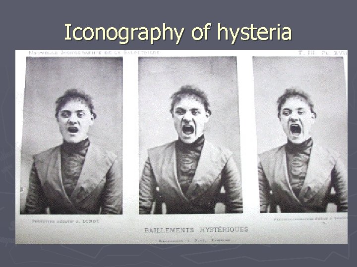 Iconography of hysteria 