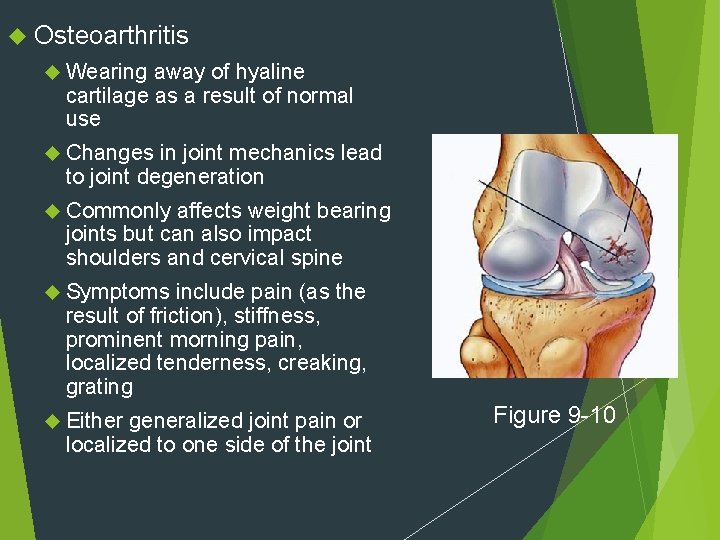  Osteoarthritis Wearing away of hyaline cartilage as a result of normal use Changes