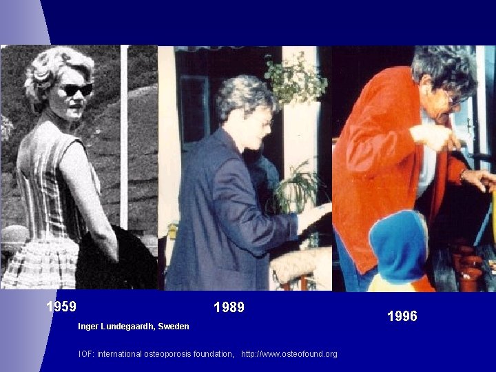 1959 1989 Inger Lundegaardh, Sweden IOF: international osteoporosis foundation, http: //www. osteofound. org 1996