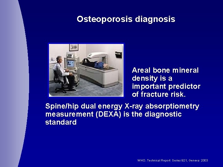 Osteoporosis diagnosis Areal bone mineral density is a important predictor of fracture risk. Spine/hip