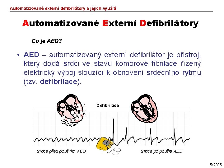 Automatizované externí defibrilátory a jejich využití Automatizované Externí Defibrilátory Co je AED? • AED