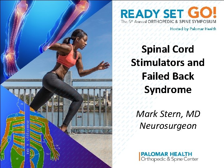 Spinal Cord Stimulators and Failed Back Syndrome Mark Stern, MD Neurosurgeon 