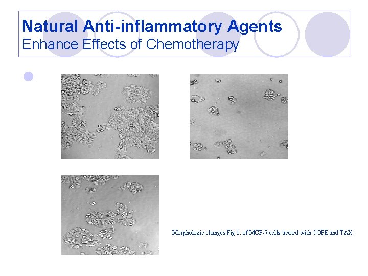 Natural Anti-inflammatory Agents Enhance Effects of Chemotherapy l Morphologic changes Fig 1. of MCF-7