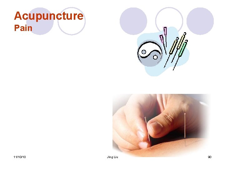 Acupuncture Pain 11/10/10 Jing Liu 90 