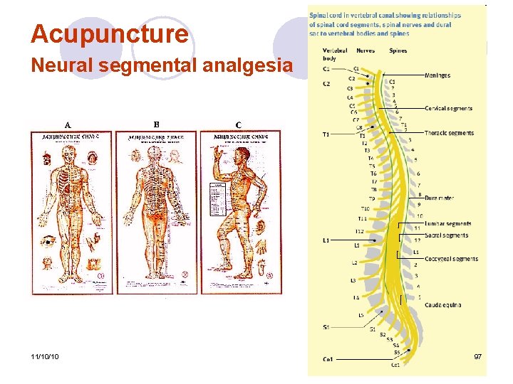 Acupuncture Neural segmental analgesia 11/10/10 97 