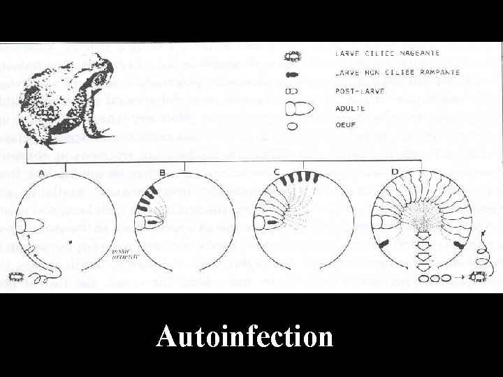 Autoinfection 