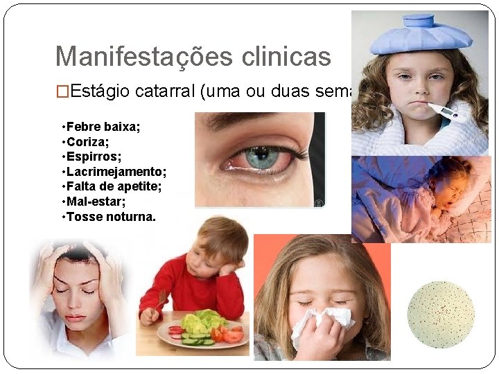 Manifestações clinicas �Estágio catarral (uma ou duas semanas): • Febre baixa; • Coriza; •