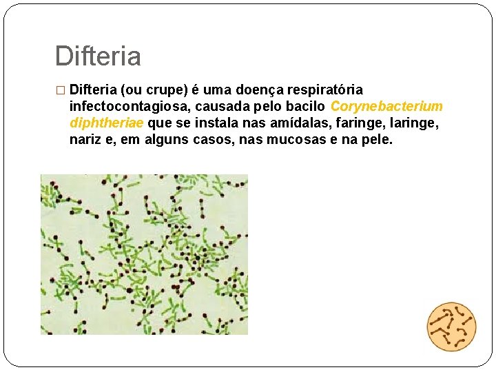 Difteria � Difteria (ou crupe) é uma doença respiratória infectocontagiosa, causada pelo bacilo Corynebacterium