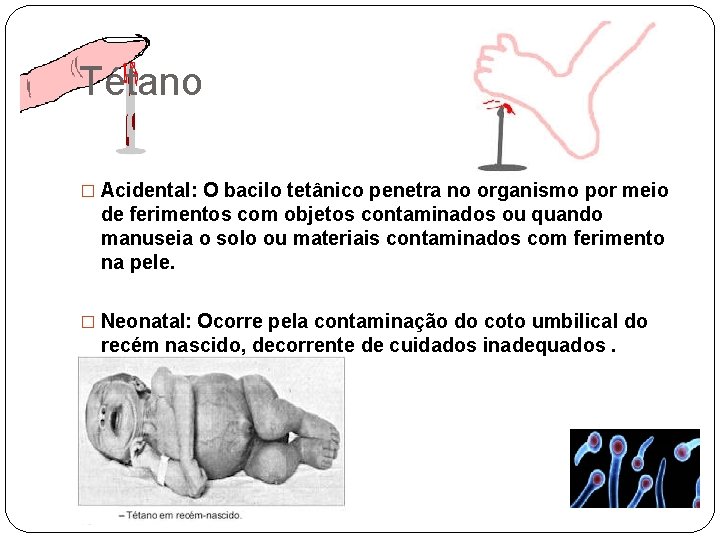 Tétano � Acidental: O bacilo tetânico penetra no organismo por meio de ferimentos com